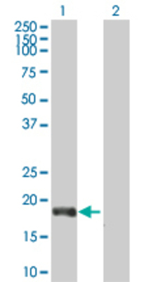 Lane 1: ROBO3 transfected lysate (16.28 KDa). Lane 2: Non-transfected lysate.
