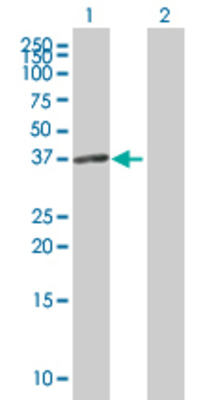 Lane 1: SGCD transfected lysate (32.2 KDa) Lane 2: Non-transfected lysate.