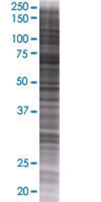 GALNT6 transfected lysate.