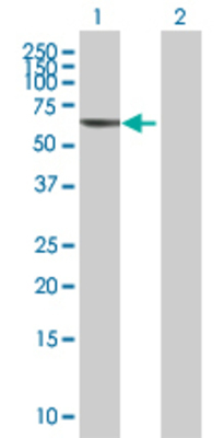Lane 1: PLA2G4C transfected lysate (60.9 KDa) Lane 2: Non-transfected lysate.