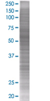 DIXDC1 transfected lysate.