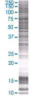 DHRS7 transfected lysate.