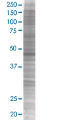 PDPK1 transfected lysate.