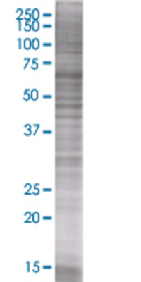 LDLR transfected lysate