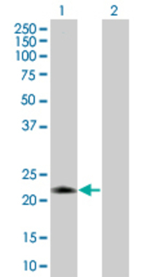 Lane 1: C1QB transfected lysate (27.94 KDa) Lane 2: Non-transfected lysate.