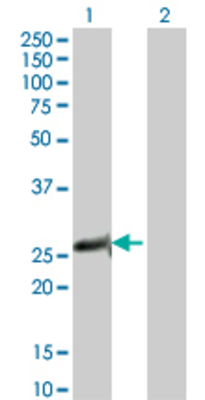 Lane 1: PSMB5 transfected lysate (29.04 KDa). Lane 2: Non-transfected lysate.