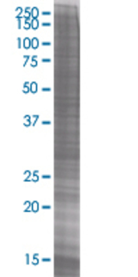 PSMB5 transfected lysate