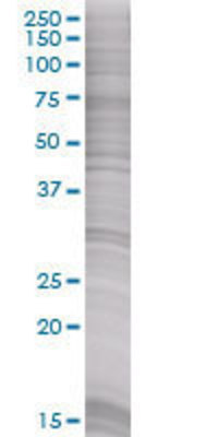 RXRB transfected lysate.