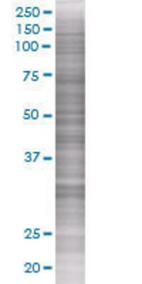 KIAA1303 transfected lysate.