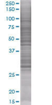 VTI1B transfected lysate