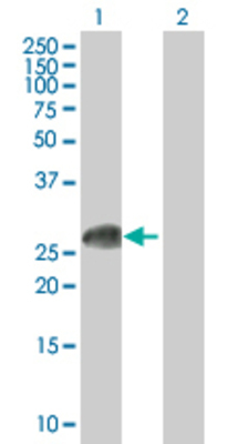 Lane 1: VTI1B transfected lysate (25.63 KDa). Lane 2: Non-transfected lysate.