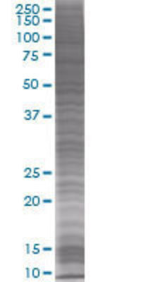 HLA-DRA transfected lysate