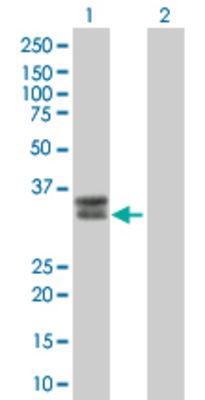 Lane 1: HLA-DRA transfected lysate (28.05 KDa). Lane 2: Non-transfected lysate.