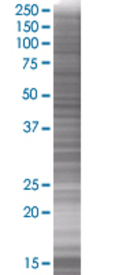 RNASEH1 transfected lysate.