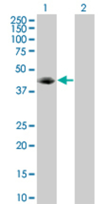 Lane 1: VASP transfected lysate (39.8 KDa) Lane 2: Non-transfected lysate.
