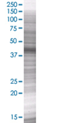 VASP transfected lysate.