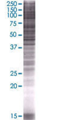 APOBEC3B transfected lysate.