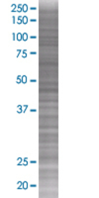HLA-DPB1 transfected lysate