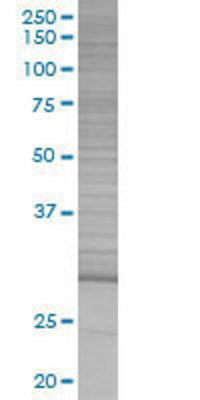 DLX1 transfected lysate.