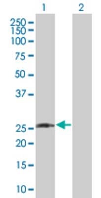 Lane 1: DLX1 transfected lysate (28.16 KDa) Lane 2: Non-transfected lysate.