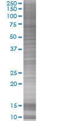 BIRC7 transfected lysate