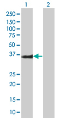 Lane 1: BIRC7 transfected lysate (32.89 KDa). Lane 2: Non-transfected lysate.