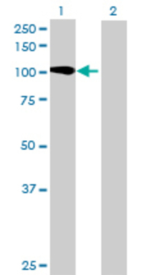 Lane 1: HERC3 transfected lysate (115.61 KDa) Lane 2: Non-transfected lysate.