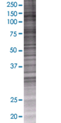 HERC3 transfected lysate.
