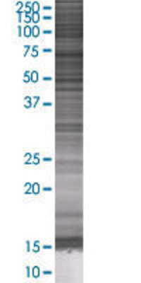 WRB transfected lysate.