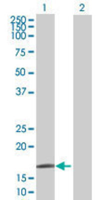 Lane 1: WRB transfected lysate (19.25 KDa) Lane 2: Non-transfected lysate.