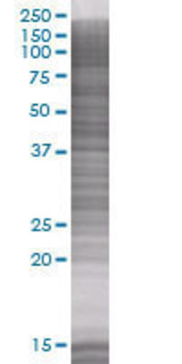 EPOR transfected lysate.