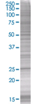 TIA1 transfected lysate