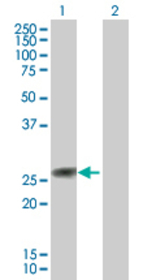 Lane 1: TIA1 transfected lysate (24.1 KDa). Lane 2: Non-transfected lysate.