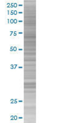 DDX20 transfected lysate.