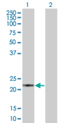 Lane 1: HPCA transfected lysate (21.23 KDa). Lane 2: Non-transfected lysate.