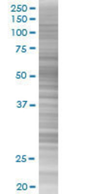 CBX6 transfected lysate.