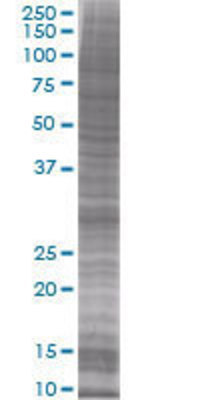 SNAI1 transfected lysate