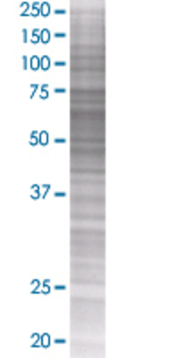 PES1 transfected lysate.