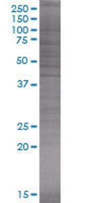 NGFRAP1 transfected lysate.