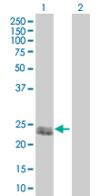 Lane 1: PDGFA transfected lysate (24 KDa). Lane 2: Non-transfected lysate.