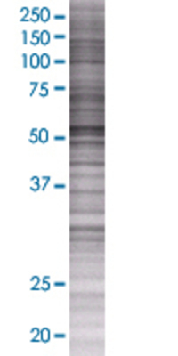 CDC14B transfected lysate.