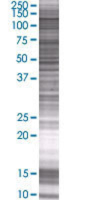 EHMT1 transfected lysate.