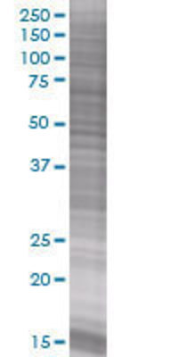 ART5 transfected lysate