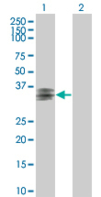 Lane 1: ART5 transfected lysate (32.23 KDa). Lane 2: Non-transfected lysate.