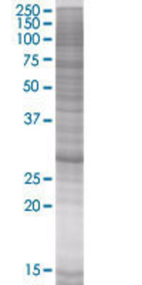 PRKAB2 transfected lysate.
