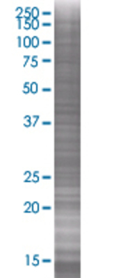 PDLIM4 transfected lysate