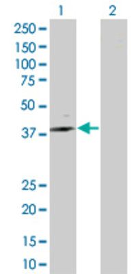Lane 1: ST6GALNAC6 transfected lysate (36.74 KDa) Lane 2: Non-transfected lysate.