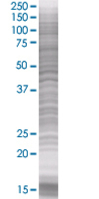 CACNG1 transfected lysate.