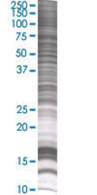 SSU72 transfected lysate.