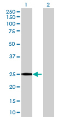 Lane 1: SSU72 transfected lysate (21.45 KDa) Lane 2: Non-transfected lysate.